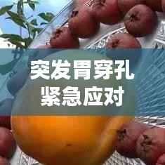 突发胃穿孔紧急应对措施指南