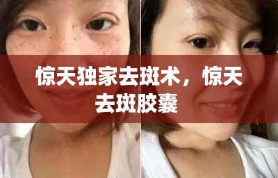 惊天独家去斑术,惊天去斑胶囊